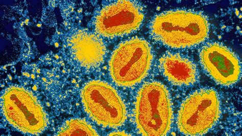 The Deadly Viruses That Vanished Without Trace Bbc Future