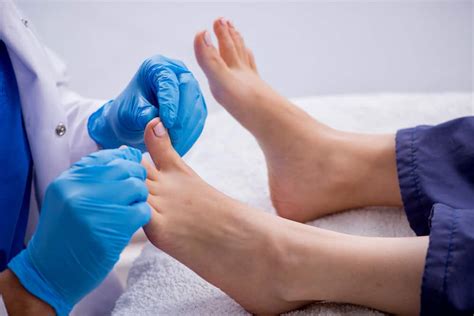 Toenail Fungus Treatment And Prevention Measures Visionsmash