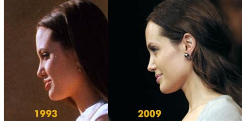 Hollywood And Bollywood Celebrity Angelina Jolie Lips Before After