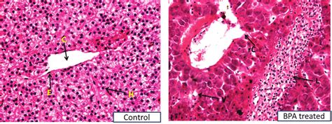 A liver biopsy involves taking a small sample of tissue from your liver. Liver tissue of C. idella from control and treated group exposed to the... | Download Scientific ...
