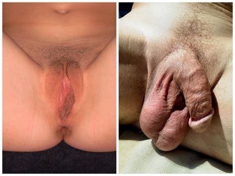 Circumcised Dick Bobs And Vagene