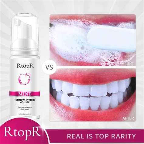 Rtopr Teeth Cleansing Whitening Mousse Removes Stains Teeth Whitening