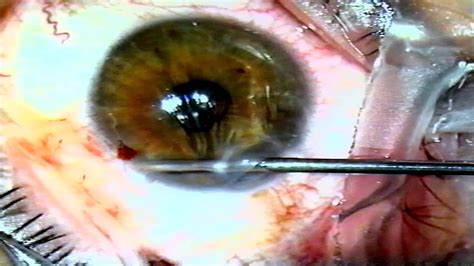 Simple Science: How to Make a Volcano with Kids