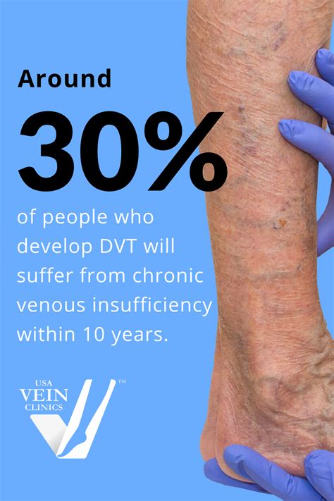 What Is Venous Reflux Disease Symptoms And Treatment Usa Vein