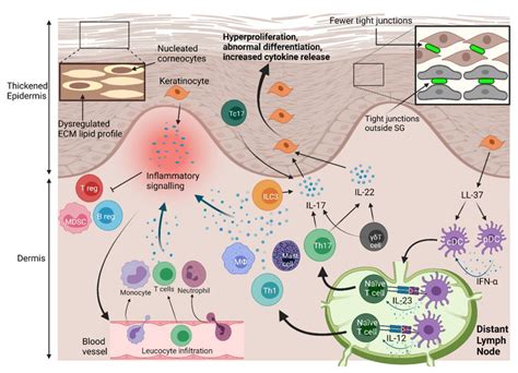 Physical And Immune Barrier Disruption In Psoriasis Hyperproliferation