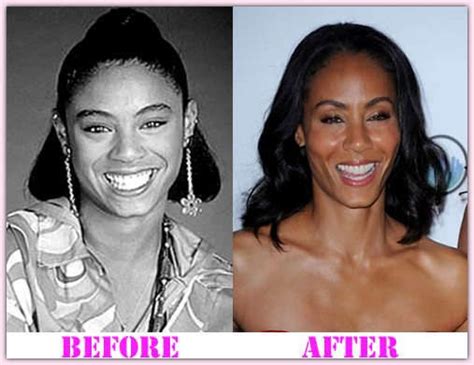 Jada Pinkett Smith Plastic Surgery Truths Finally Comes Out