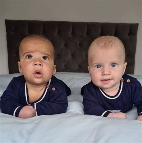 Unique Twins Who Are Completely Different From Each Other