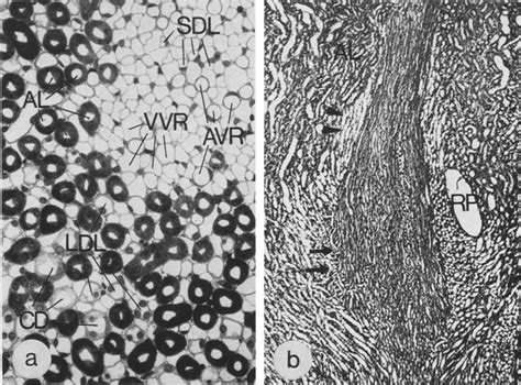 A Cross Section Through A Vascular Bundle And The Adjacent