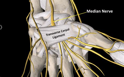 Carpal Tunnel Release And Wrist Instability Regenexx