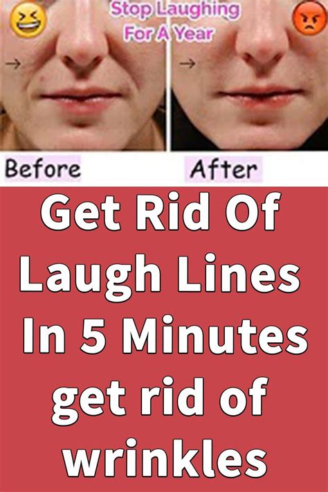 How To Get Rid Of Laugh Lines