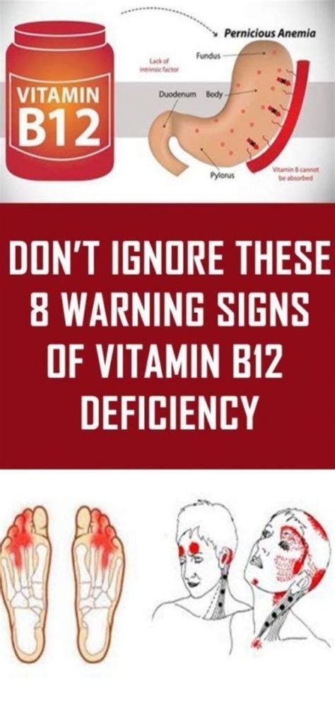 Warning Signs Of Vitamin B Deficiency B Deficiency Signs