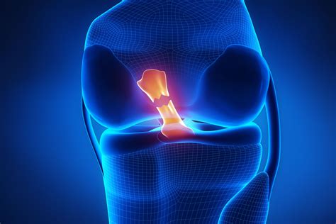 Acl Injury Knee Pain Berry Physiotherapy Mobile Physiotherapy Toronto