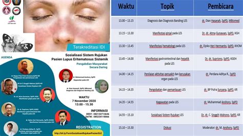 Sosialisasi Sistem Rujukan Pasien Lupus Eritematosus Sistemik YouTube