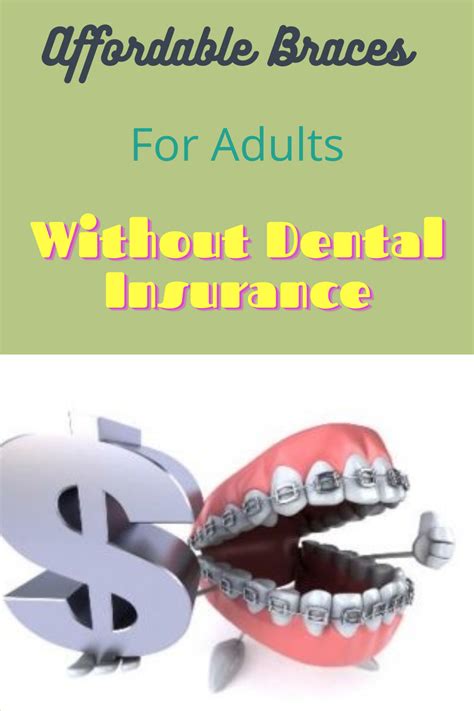Monthly Payment Plans For Dental Braces Without Insurance Affordable Braces Dental Dental Braces