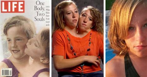 what do they look like now conjoined twins abby and brittany hensel in 2018 jesus daily