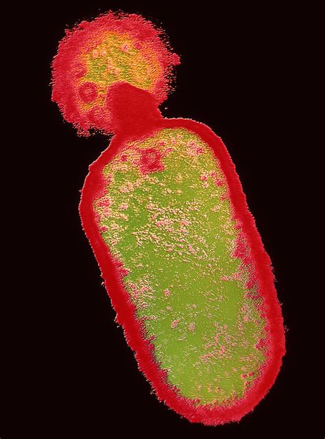 Listeria Bacteria Photograph By Dr Kari Lounatmaa Fine Art America