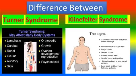 Difference Between Turner Syndrome And Klinefelter Syndrome Youtube
