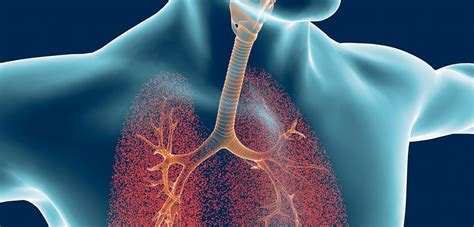 Lung Disease Mucus Asthma Lung Disease