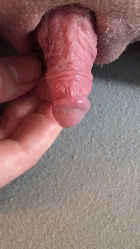 Enlarged Clitoris Penis