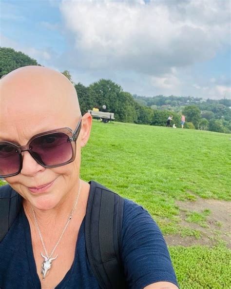 Scots Tv Host Gail Porter Told She Could Be Pretty Again If She Wore A Wig