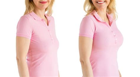 Breast Lift Vs Breast Augmentation Deciding Which Is Right For You Las Vegas Body Sculpting