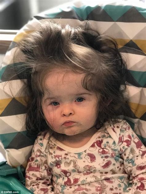It grows everywhere on your baby, except for the palms, lips, and soles of the feet. Devon mother of baby born with long hair reveals her shock ...