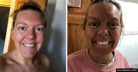 Woman Aghast After Double Spray Tan Leaves Her Looking Like Ross From