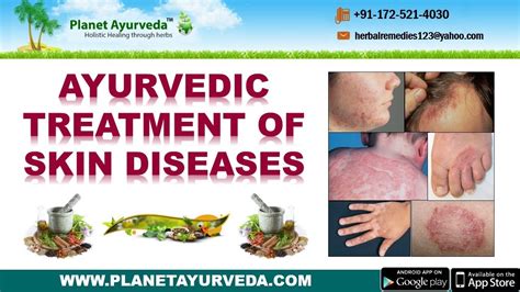 Ayurvedic Treatment Of Skin Diseases Types Causes Symptoms Herbal