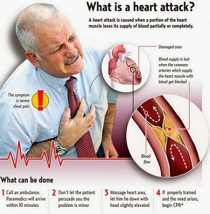 Tanda sakit jantung wanita dan lelaki berbeza! Perbezaan Antara Sakit Jantung, Serangan Jantung & Strok ...