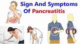 Images of Pancreatic Cancer Nausea Treatment