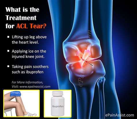 Anterior cruciate ligament (acl) injury. Treatment for ACL Tear|Surgery|Post Operative Rehab|Recovery
