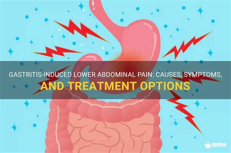 Gastritis Induced Lower Abdominal Pain Causes Symptoms And Treatment Options Medshun