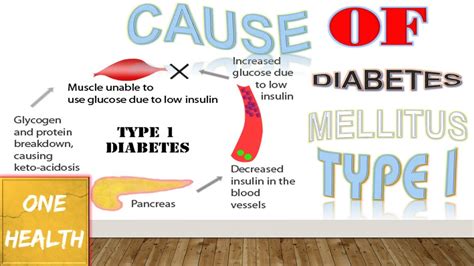 Diabetes Mellitus Type 1 One Health Youtube