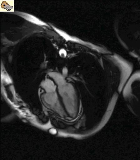 Cardiac Mri Gif Cardiac Mri Heartbeat Discover Share Vrogue Co