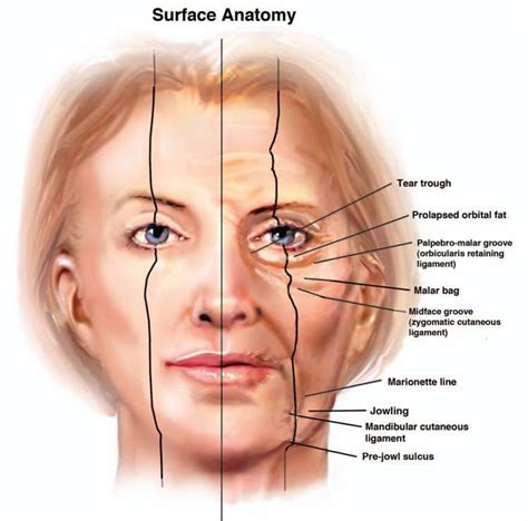 Image Result For Orbicularis Retaining Ligament Facial Aging Facial