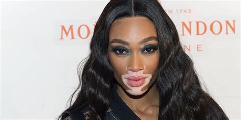Winnie Harlow Gushes Over Sports Illustrated Swimsuit Gig Were