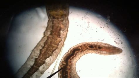 Biology Cool Microscopic Pond Water Organisms Oligiochaete Worm