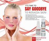 Skincare And Makeup For Rosacea