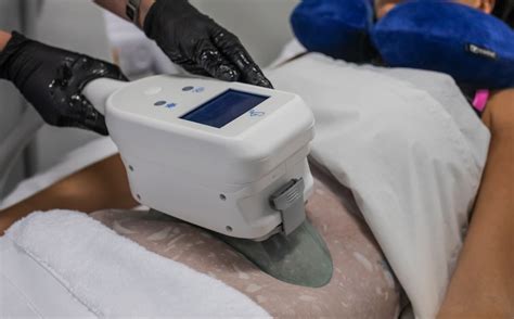 Cryolipolysis Beaumont Aesthetic Clinic