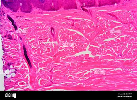 Human Skin Showing Epidermis Dermis With Sweat Glands And Connective