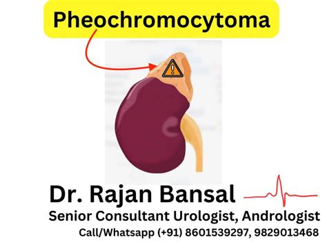Pheochromocytoma Treatment In Jaipur Rajasthan