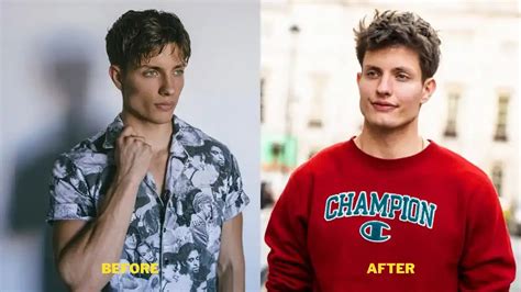 Matt Rife Plastic Surgery And Weight Loss Glow Up And Before After Pictures