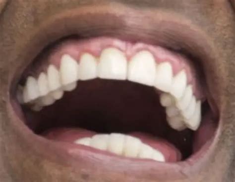 Denzel Washington Teeth And Smile Pictures