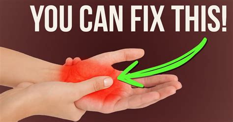 How To Get Rid Of Arm Pain And Tingling Hands I Liebscher And Bracht