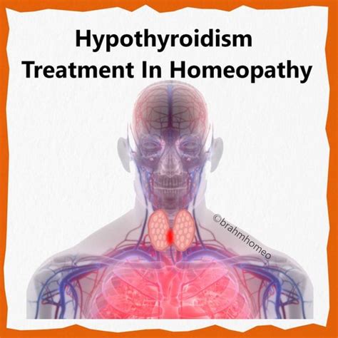 Hypothyroidism Treatment Hypothyroidism Treatment In Homeopathy