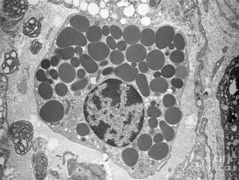 Fat Cell Tem Photograph By David M Phillips