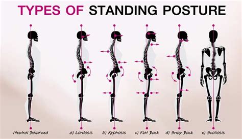 Why Does Posture Matter — Kinect Health