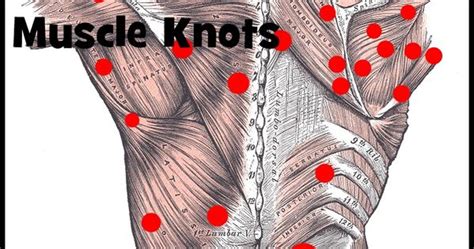 Effective Trigger Point Therapy For Muscle Knots Muscle Knots