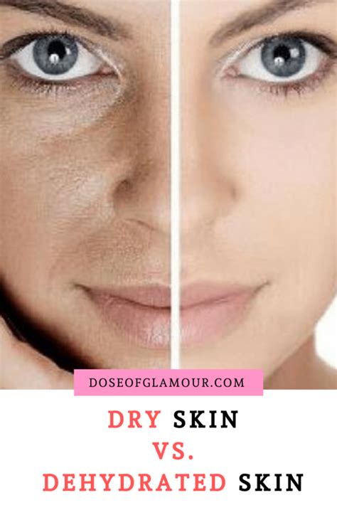 Differences Between Dry And Dehydrated Skin With Love And Beauty Visit