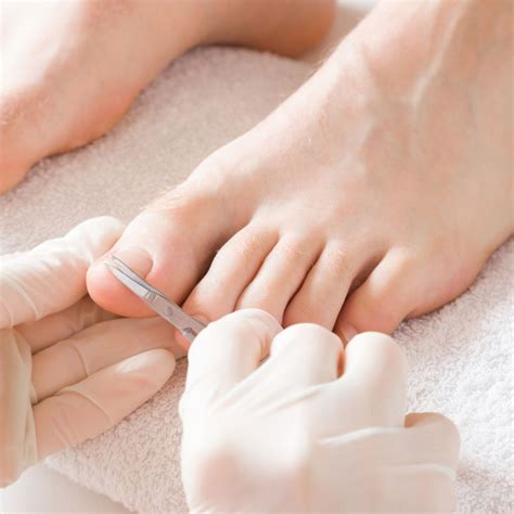 Home Advanced Foot Care Nurse And Wellness Foot Care Nurse In Emeryville On